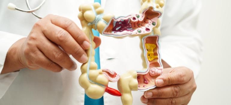 NFZ: na nowotwór jelita grubego zapada rocznie około 18 tys. osób w Polsce
