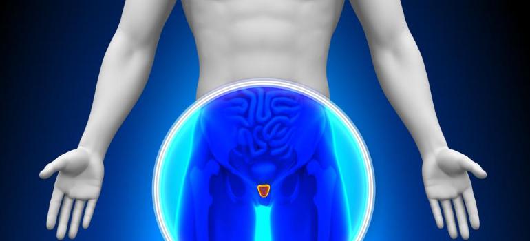 Wysoka umieralność na raka prostaty w Polsce